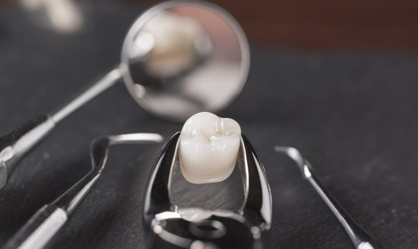 Featured image for “Essential Tips for a Smooth Tooth Extraction Recovery”