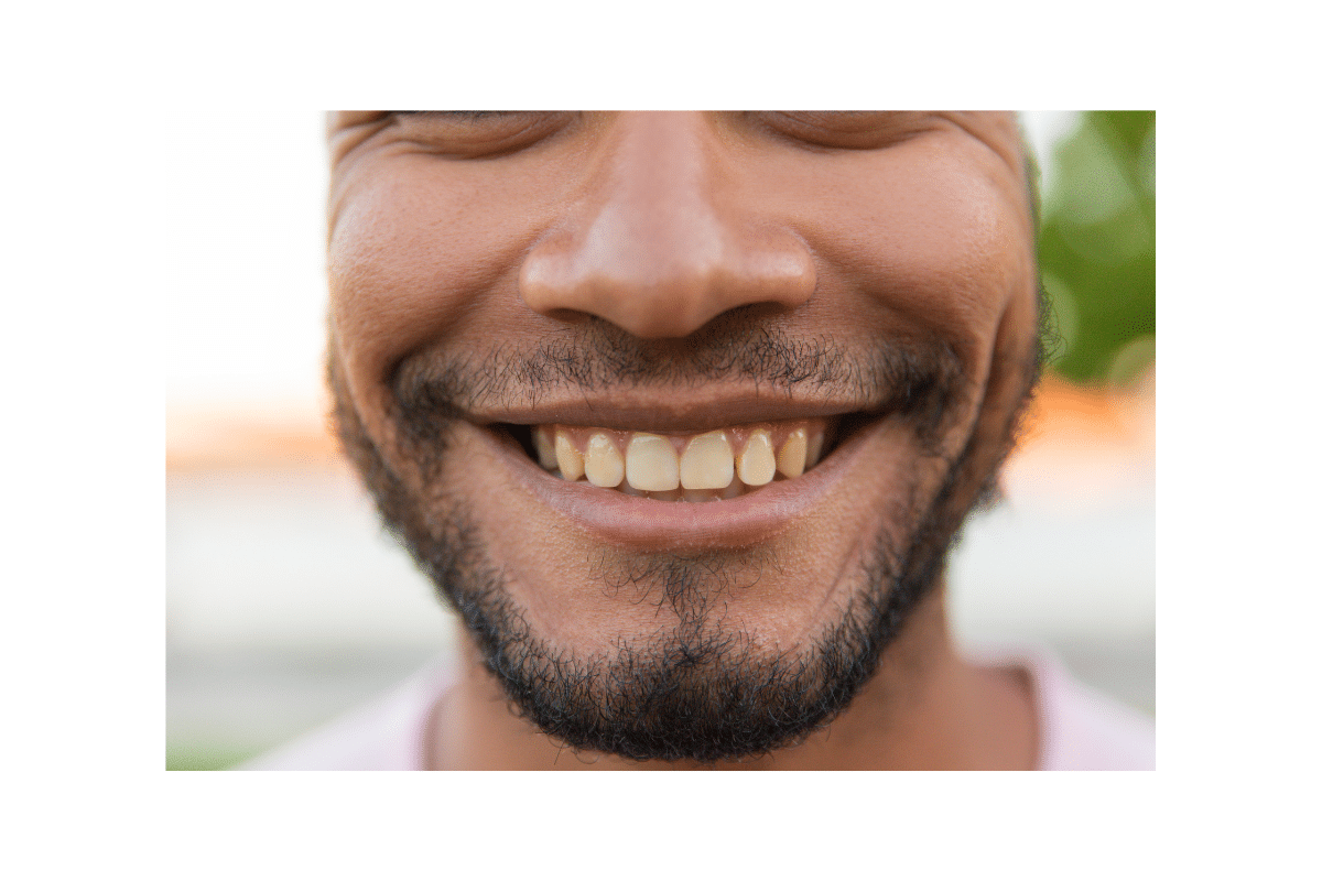 Featured image for “What Are the Common Causes of Tooth Stains?”