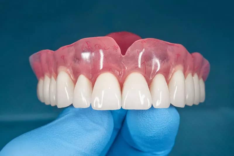 dentures procedure