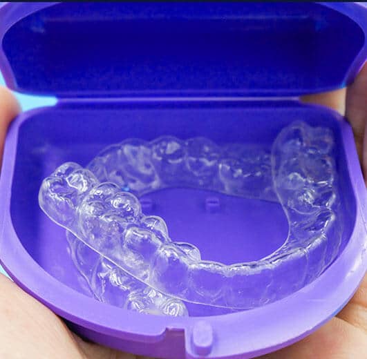 invisalign aligners