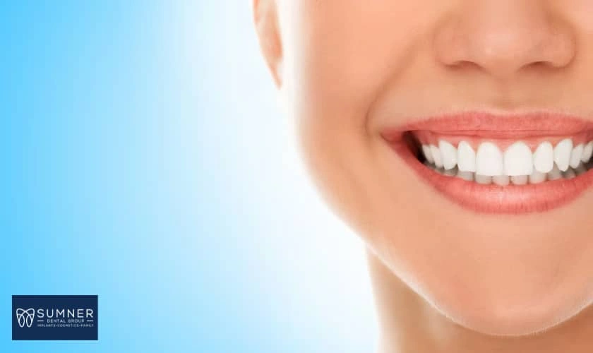 6 Benefits of Whitening Teeth