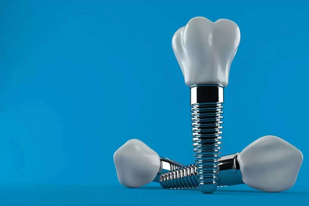 Are Dental Implants Safe?
