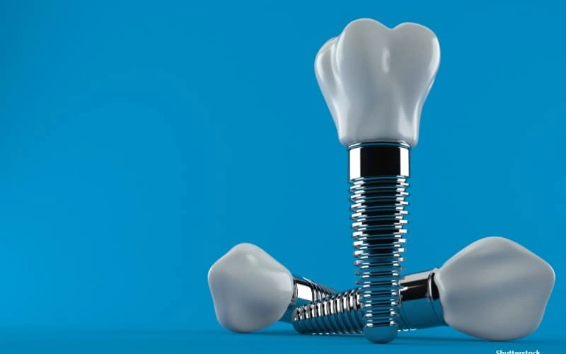 Fright-Free Smile: How Dental Implants Can Restore Your Confidence This Halloween