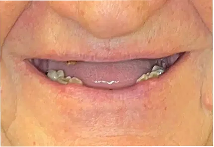 Patient condition before treatment