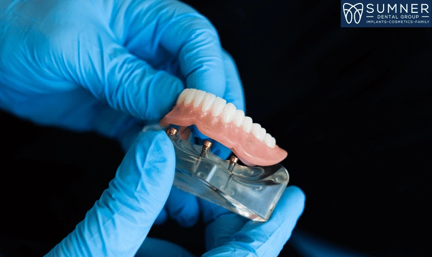 How Dentures Helps To Smile Beautifully With Confidence