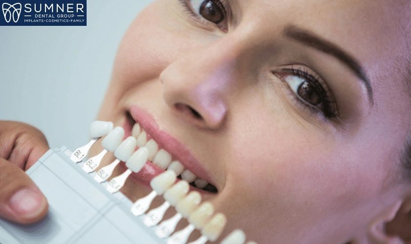 How to Take Care of Dental Veneers