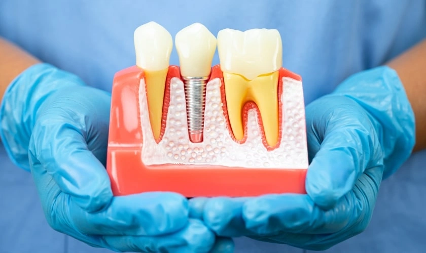 Recognizing Failure: Signs Your Dental Implant May Need Professional Attention