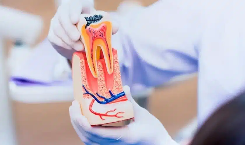 Understanding Root Canal Treatment